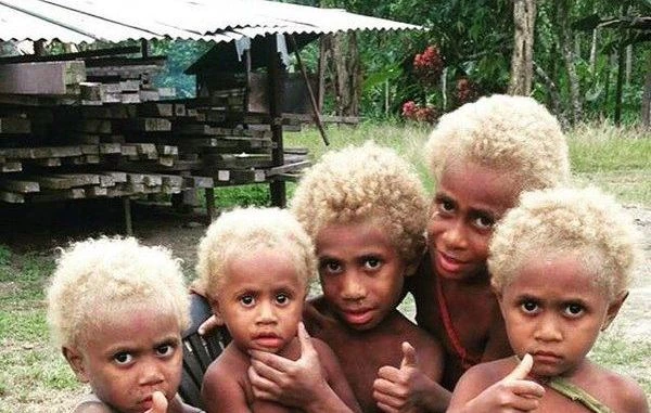 Meet The World's Only Natural Black Blondes